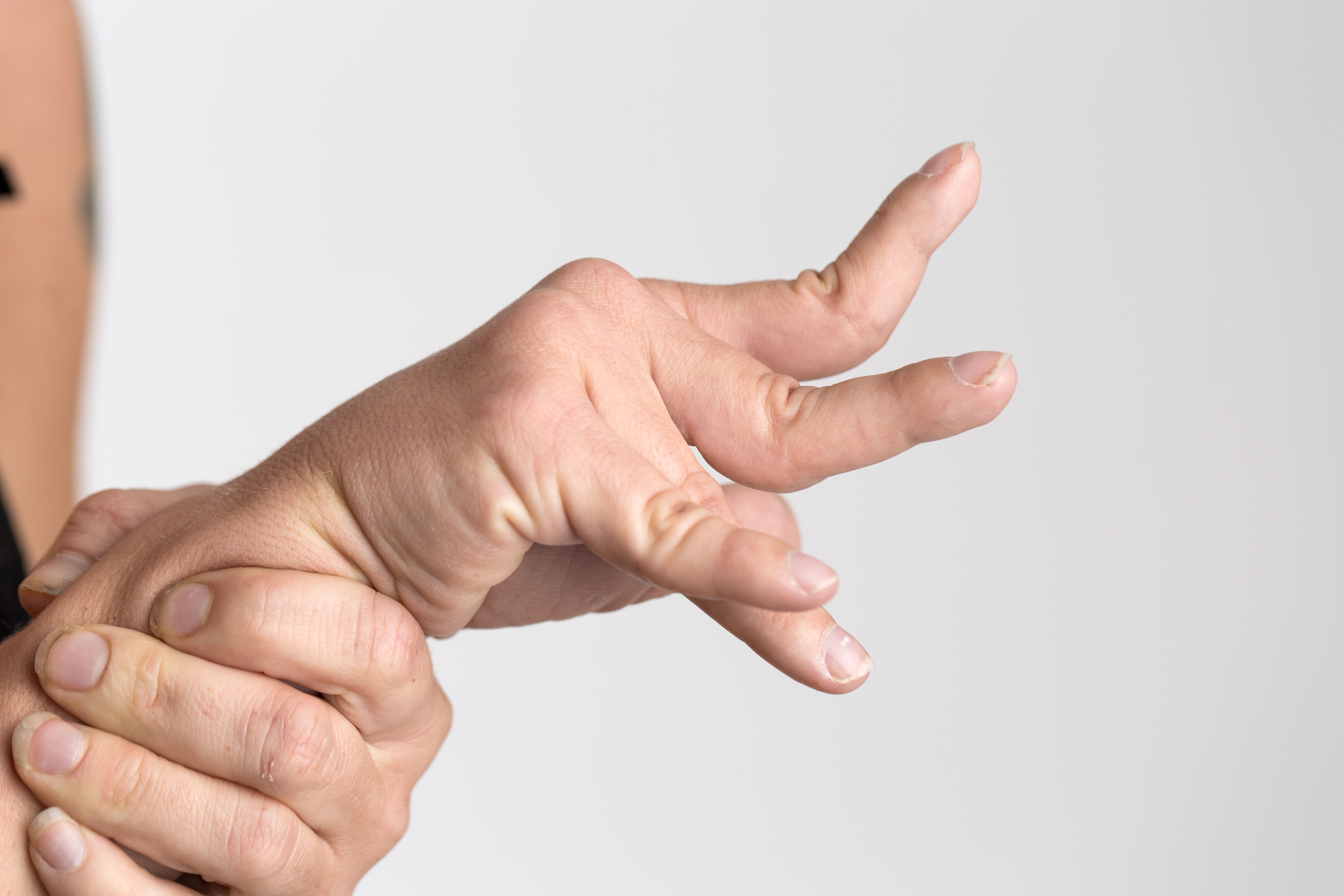 Spasticity