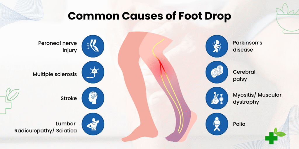 Foot Drop
